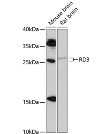 RD3 Rabbit Polyclonal Antibody