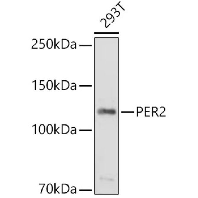 PER2 Rabbit Polyclonal Antibody