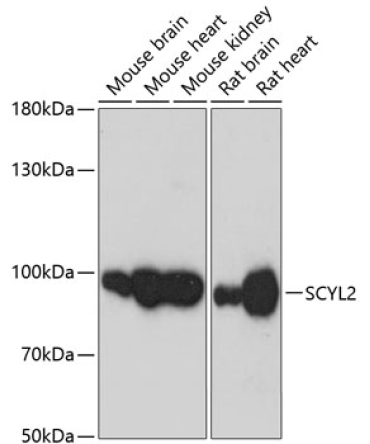 SCYL2 Rabbit Polyclonal Antibody