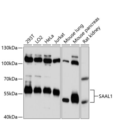 SAAL1 Rabbit Polyclonal Antibody