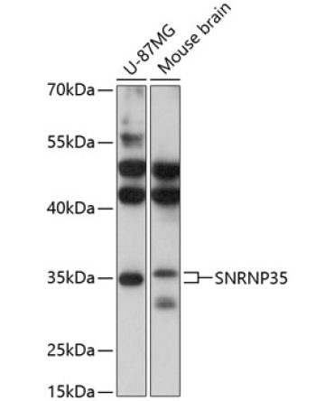 SNRNP35 Rabbit Polyclonal Antibody