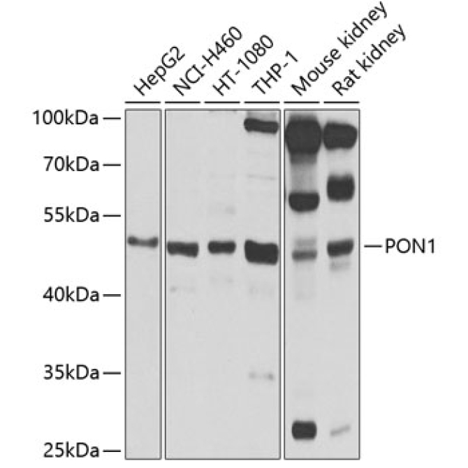 PON1 Rabbit Polyclonal Antibody