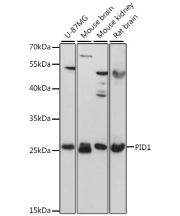 PID1 Rabbit Polyclonal Antibody