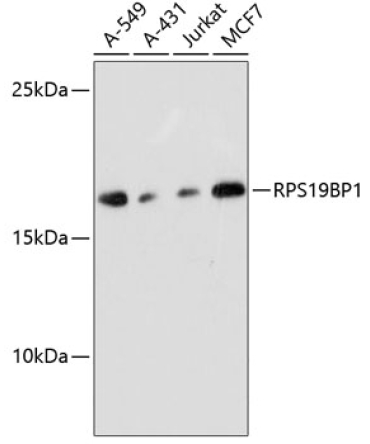 RPS19BP1 Rabbit Polyclonal Antibody