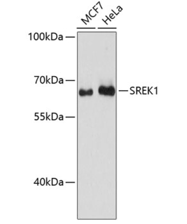 SREK1 Rabbit Polyclonal Antibody