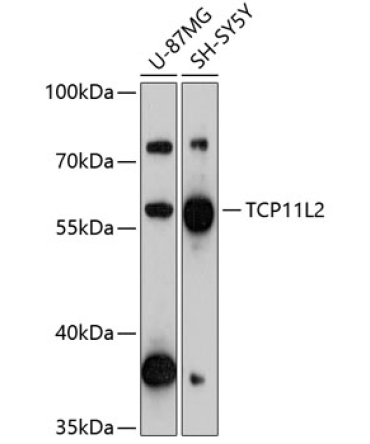 TCP11L2 Rabbit Polyclonal Antibody