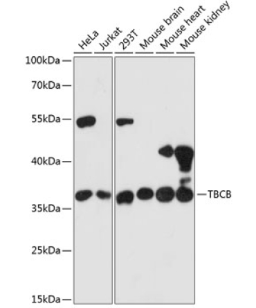 TBCB Rabbit Polyclonal Antibody