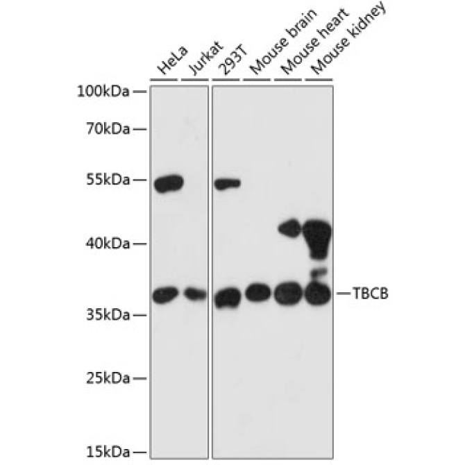 TBCB Rabbit Polyclonal Antibody