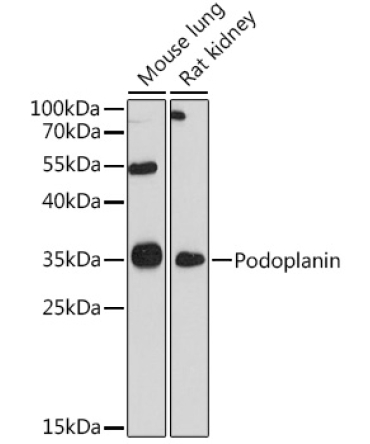 Podoplanin Rabbit Polyclonal Antibody