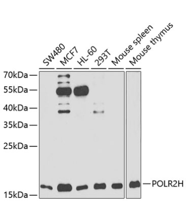POLR2H Rabbit Polyclonal Antibody