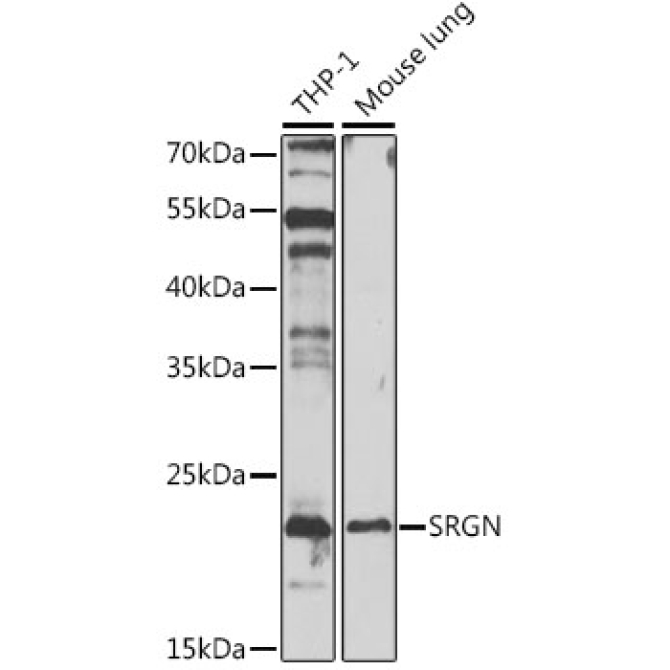 SRGN Rabbit Polyclonal Antibody