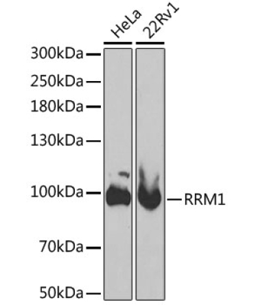 RRM1 Rabbit Polyclonal Antibody