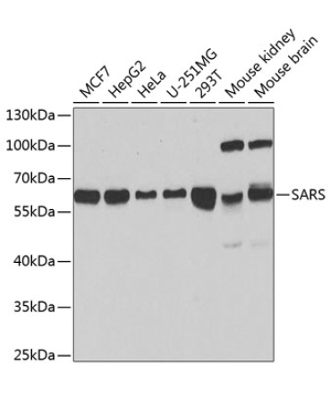 SARS Rabbit Polyclonal Antibody