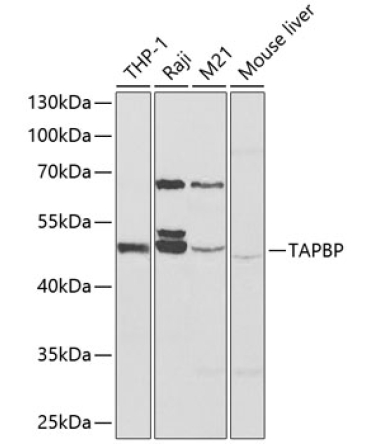 TAPBP Rabbit Polyclonal Antibody