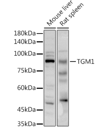 TGM1 Rabbit Polyclonal Antibody