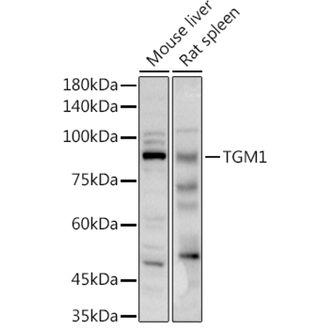TGM1 Rabbit Polyclonal Antibody