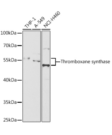 Thromboxane synthase Rabbit Polyclonal Antibody