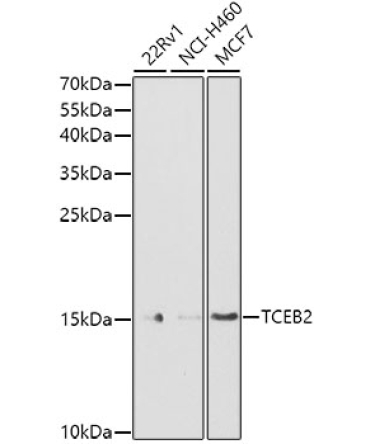 TCEB2 Rabbit Polyclonal Antibody