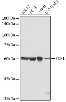 TCP1 Rabbit Polyclonal Antibody
