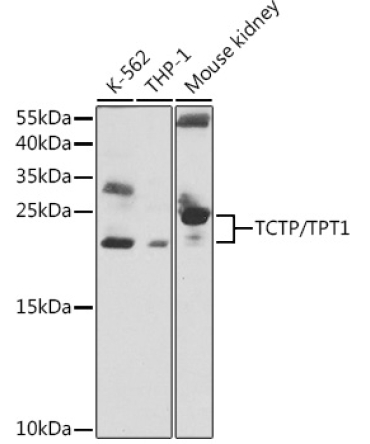 TCTP/TPT1 Rabbit Polyclonal Antibody