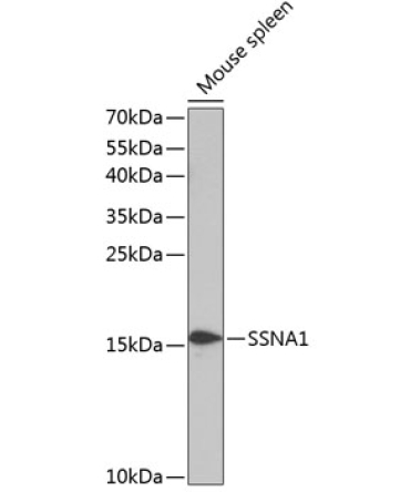 SSNA1 Rabbit Polyclonal Antibody