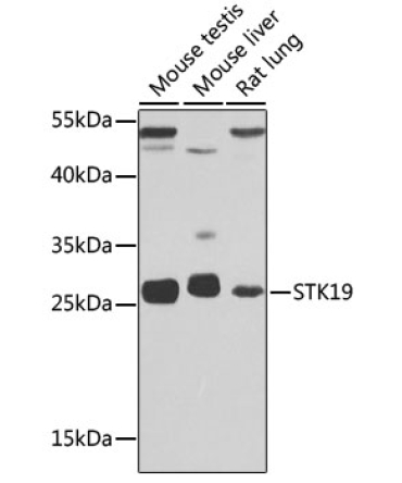 STK19 Rabbit Polyclonal Antibody