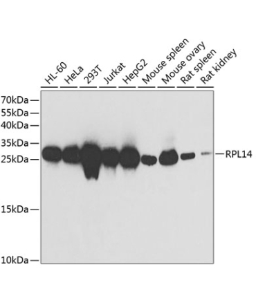 RPL14 Rabbit Polyclonal Antibody