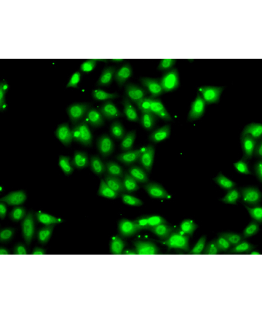 PIAS3 Rabbit Polyclonal Antibody