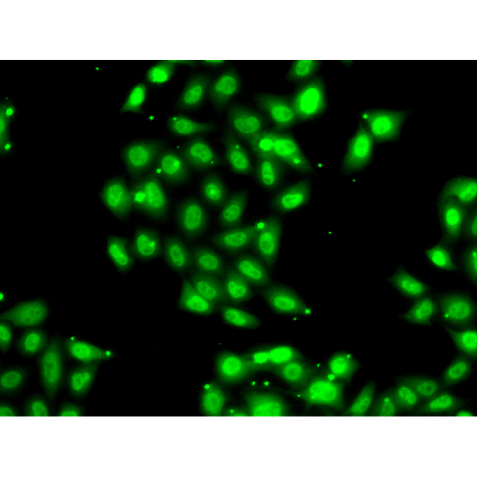 PIAS3 Rabbit Polyclonal Antibody