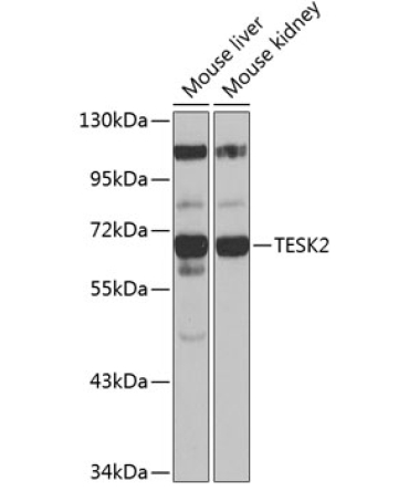 TESK2 Rabbit Polyclonal Antibody