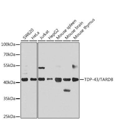 TDP-43/TARDBP Rabbit Polyclonal Antibody