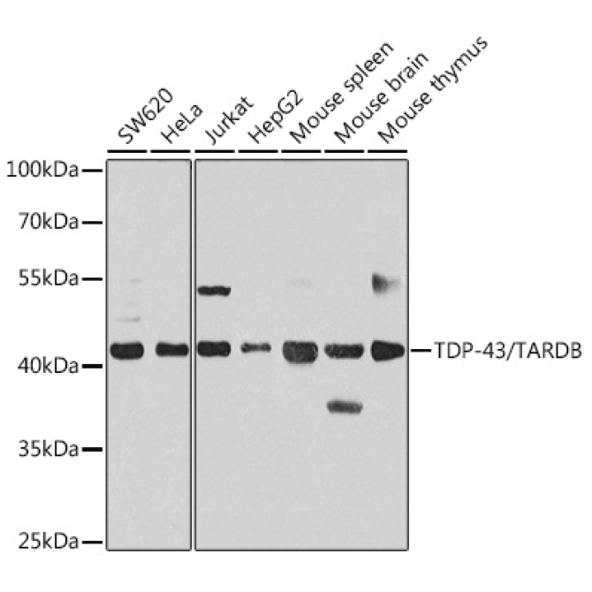 TDP-43/TARDBP Rabbit Polyclonal Antibody