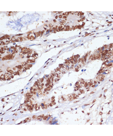 PELP1 Rabbit Polyclonal Antibody