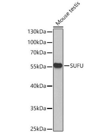 SUFU Rabbit Polyclonal Antibody
