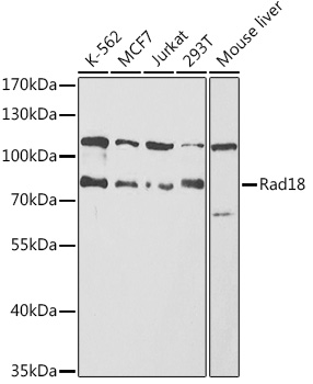 Rad18 Rabbit Polyclonal Antibody