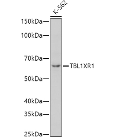 TBL1XR1 Rabbit Polyclonal Antibody