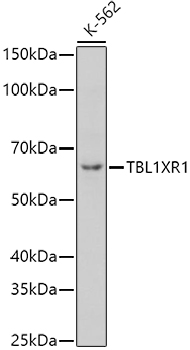 TBL1XR1 Rabbit Polyclonal Antibody