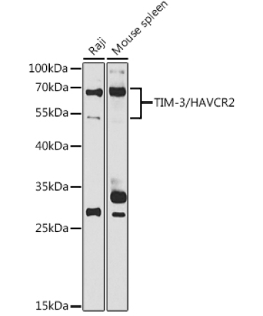 TIM-3/HAVCR2 Rabbit Polyclonal Antibody