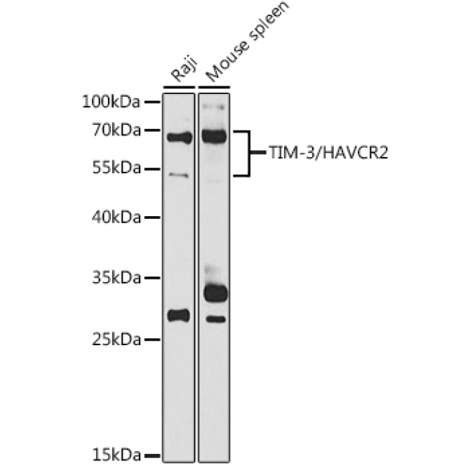TIM-3/HAVCR2 Rabbit Polyclonal Antibody