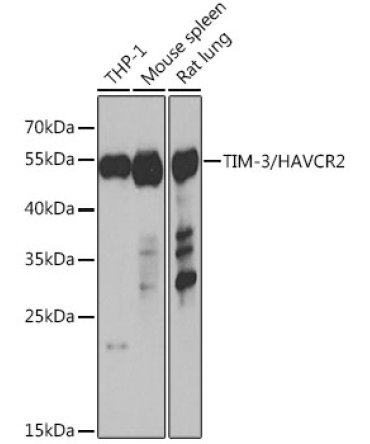 TIM-3/HAVCR2 Rabbit Polyclonal Antibody