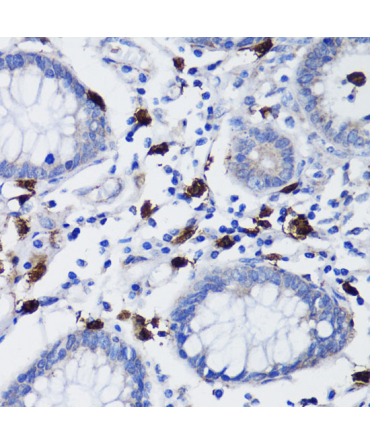 TET3 Rabbit Polyclonal Antibody