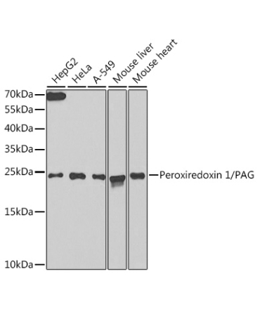 Peroxiredoxin 1/PAG Rabbit Polyclonal Antibody