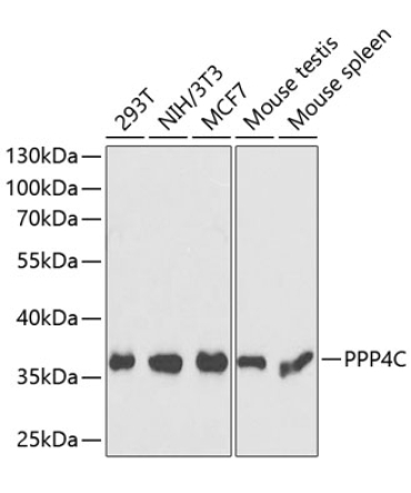 PPP4C Rabbit Polyclonal Antibody