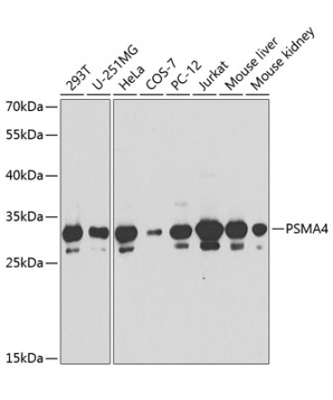 PSMA4 Rabbit Polyclonal Antibody