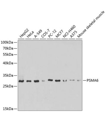 PSMA6 Rabbit Polyclonal Antibody