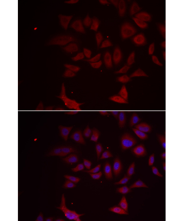 RPL11 Rabbit Polyclonal Antibody