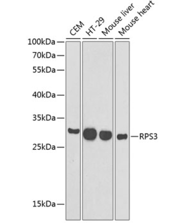 RPS3 Rabbit Polyclonal Antibody