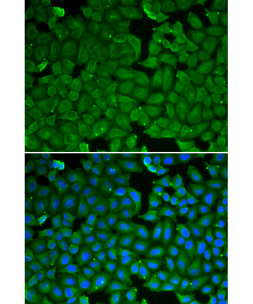 SPINK1 Rabbit Polyclonal Antibody