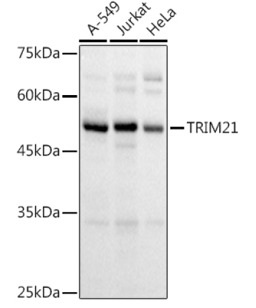 TRIM21/SS-A Rabbit Polyclonal Antibody