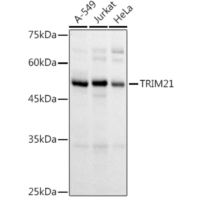 TRIM21/SS-A Rabbit Polyclonal Antibody
